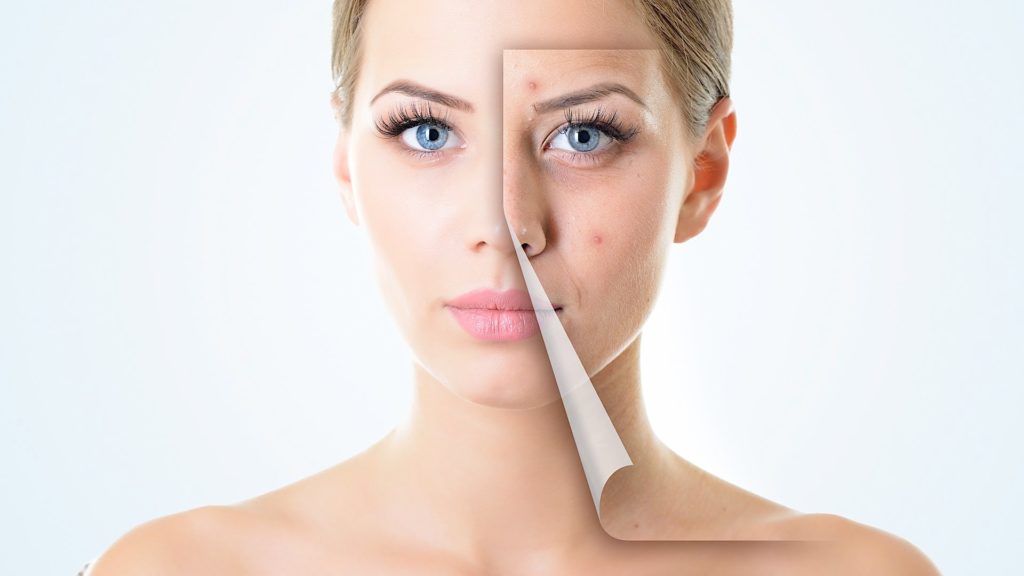 HealthySkin