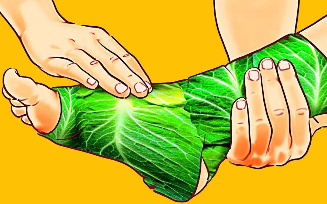 Wrapping leg in cabbage for pain relief