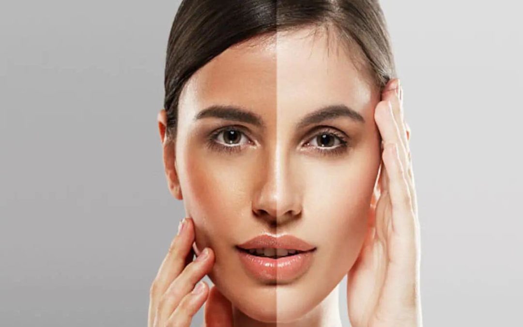 Best natural Skin Whitening Remedies at home