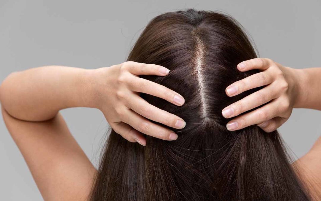 Herbs for Hair Loss Treatment