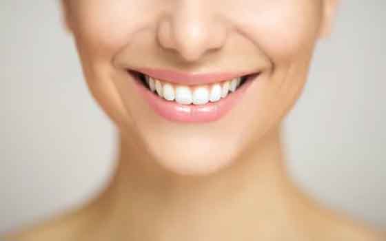 Tooth Whitening