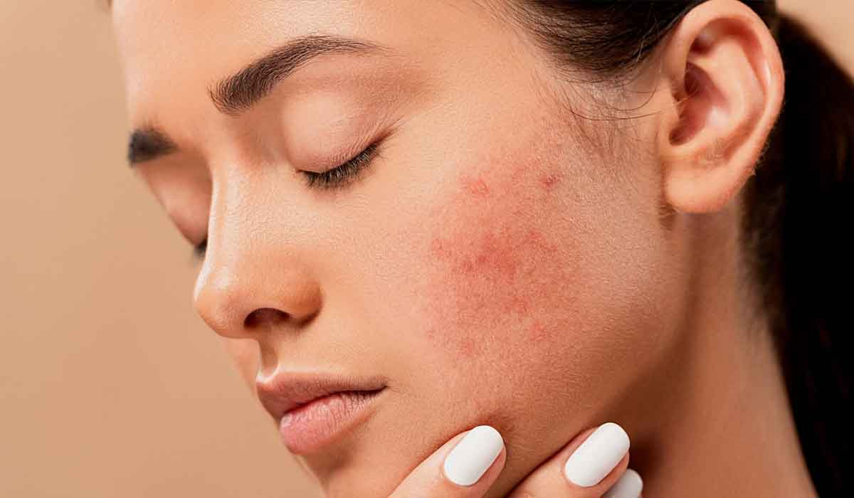 Skin Pigmentation: Causes, Types, And Treatment