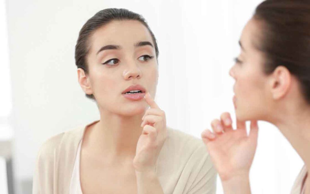 How to Keep Your Lips Moist and Soft