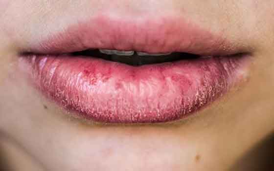 lips care matters